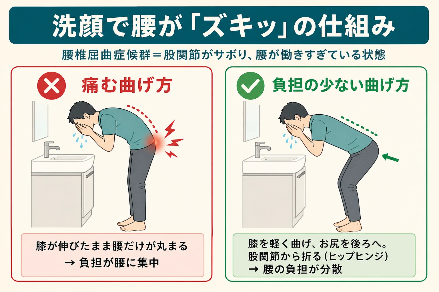 洗顔で腰が痛む仕組みの比較図：膝が伸びたまま腰だけ丸まると負担が腰に集中／膝を曲げてお尻を後ろに引くヒップヒンジなら腰の負担が分散