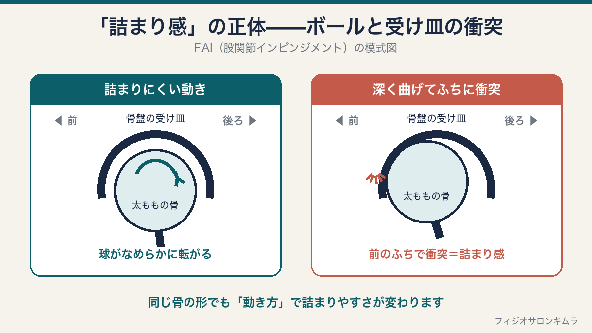 股関節をボールと受け皿にたとえた模式図。球がなめらかに転がる場合と、深く曲げたときに前のふちで衝突して詰まり感が出る場合（FAI）の比較