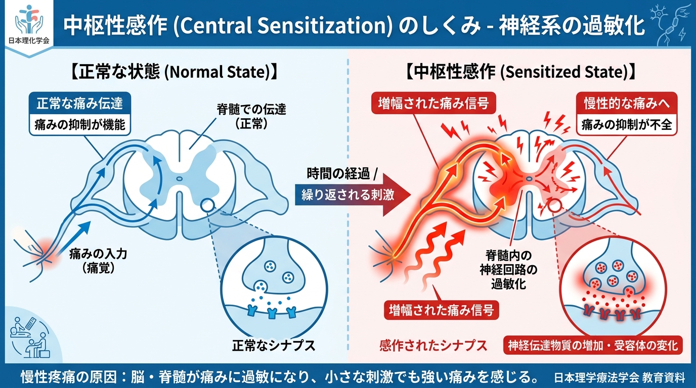 中枢性感作のしくみ図解